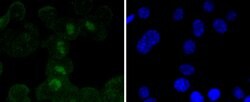 Invitrogen SOX11 Recombinant Rabbit Monoclonal Antibody (SD203-08) 100