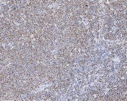 Invitrogen SOX11 Recombinant Rabbit Monoclonal Antibody (SD203-08) 100