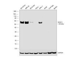 Invitrogen SOX11 Recombinant Rabbit Monoclonal Antibody (SD203-08) 100