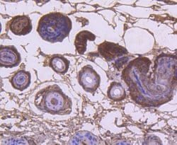 Invitrogen KRT9 Recombinant Rabbit Monoclonal Antibody (SD201-09) 100 &mu;L;