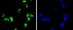 Invitrogen CDK9 Recombinant Rabbit Monoclonal Antibody (SD204-07) 100 &mu;L;