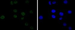 Invitrogen CDK9 Recombinant Rabbit Monoclonal Antibody (SD204-07) 100 &mu;L;