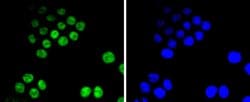 Invitrogen CDK9 Recombinant Rabbit Monoclonal Antibody (SD204-07) 100 &mu;L;