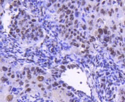 Invitrogen CDK9 Recombinant Rabbit Monoclonal Antibody (SD204-07) 100 &mu;L;