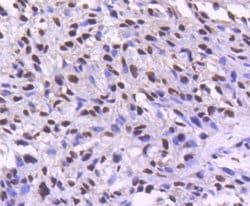 Invitrogen CDK9 Recombinant Rabbit Monoclonal Antibody (SD204-07) 100 &mu;L;