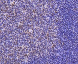 Invitrogen CDK9 Recombinant Rabbit Monoclonal Antibody (SD204-07) 100 &mu;L;