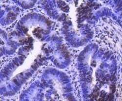 Invitrogen CDK9 Recombinant Rabbit Monoclonal Antibody (SD204-07) 100 &mu;L;