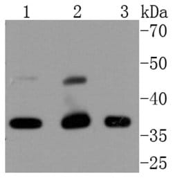 Invitrogen CDK9 Recombinant Rabbit Monoclonal Antibody (SD204-07) 100 &mu;L;