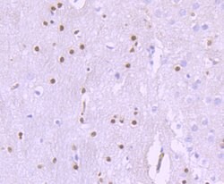 Invitrogen SOX10 Recombinant Rabbit Monoclonal Antibody (SD204-04) 100