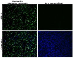 Invitrogen SOX10 Recombinant Rabbit Monoclonal Antibody (SD204-04) 100