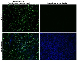 Invitrogen SOX10 Recombinant Rabbit Monoclonal Antibody (SD204-04) 100