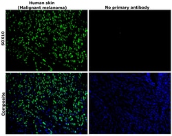Invitrogen SOX10 Recombinant Rabbit Monoclonal Antibody (SD204-04) 100