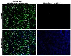 Invitrogen SOX10 Recombinant Rabbit Monoclonal Antibody (SD204-04) 100