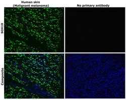 Invitrogen SOX10 Recombinant Rabbit Monoclonal Antibody (SD204-04) 100