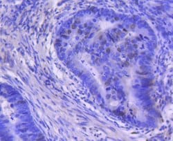 Invitrogen Cyclin A Recombinant Rabbit Monoclonal Antibody (SD2053) 100
