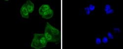 Invitrogen UBE1 Recombinant Rabbit Monoclonal Antibody (SD08-62) 100 &mu;L;
