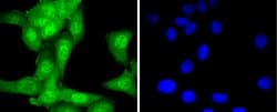 Invitrogen UBE1 Recombinant Rabbit Monoclonal Antibody (SD08-62) 100 &mu;L;
