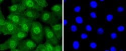 Invitrogen UBE1 Recombinant Rabbit Monoclonal Antibody (SD08-62) 100 &mu;L;