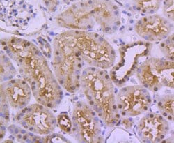 Invitrogen UBE1 Recombinant Rabbit Monoclonal Antibody (SD08-62) 100 &mu;L;