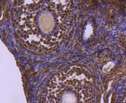 Invitrogen UBE1 Recombinant Rabbit Monoclonal Antibody (SD08-62) 100 &mu;L;