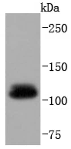 Invitrogen UBE1 Recombinant Rabbit Monoclonal Antibody (SD08-62) 100 &mu;L;