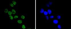 Invitrogen Cdc40 Recombinant Rabbit Monoclonal Antibody (SD085-9) 100 &mu;L;