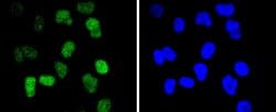Invitrogen Cdc40 Recombinant Rabbit Monoclonal Antibody (SD085-9) 100 &mu;L;