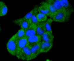 Invitrogen HSP105 Recombinant Rabbit Monoclonal Antibody (SD85-06) 100