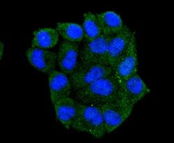 Invitrogen HSP105 Recombinant Rabbit Monoclonal Antibody (SD85-06) 100