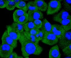 Invitrogen HSP105 Recombinant Rabbit Monoclonal Antibody (SD85-06) 100