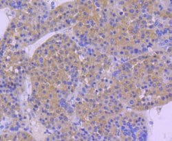 Invitrogen HSP105 Recombinant Rabbit Monoclonal Antibody (SD85-06) 100