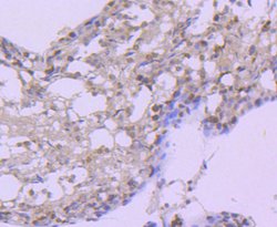 Invitrogen HSP105 Recombinant Rabbit Monoclonal Antibody (SD85-06) 100