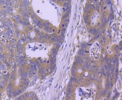 Invitrogen HSP105 Recombinant Rabbit Monoclonal Antibody (SD85-06) 100