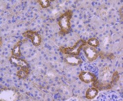 Invitrogen HSPA14 Recombinant Rabbit Monoclonal Antibody (SD08-48) 100