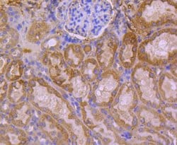 Invitrogen HSPA14 Recombinant Rabbit Monoclonal Antibody (SD08-48) 100
