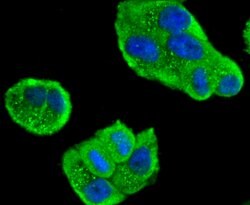 Invitrogen MEKK3 Recombinant Rabbit Monoclonal Antibody (SD0839) 100 &mu;L;