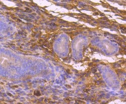 Invitrogen MEKK3 Recombinant Rabbit Monoclonal Antibody (SD0839) 100 &mu;L;