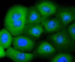 Invitrogen 14-3-3 beta Recombinant Rabbit Monoclonal Antibody (SD0837)