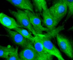 Invitrogen 14-3-3 beta Recombinant Rabbit Monoclonal Antibody (SD0837)
