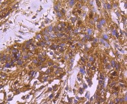 Invitrogen 14-3-3 beta Recombinant Rabbit Monoclonal Antibody (SD0837)