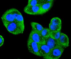 Invitrogen Cdc34 Recombinant Rabbit Monoclonal Antibody (JJ086-07) 100