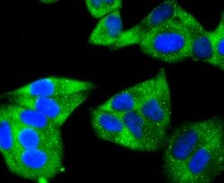 Invitrogen HSPB8 Recombinant Rabbit Monoclonal Antibody (JJ08-53) 100 &mu;L;