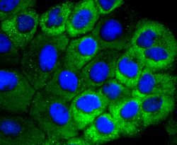 Invitrogen HSPB8 Recombinant Rabbit Monoclonal Antibody (JJ08-53) 100 &mu;L;