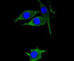 Invitrogen HSPB8 Recombinant Rabbit Monoclonal Antibody (JJ08-53) 100 &mu;L;
