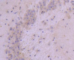 Invitrogen HSPB8 Recombinant Rabbit Monoclonal Antibody (JJ08-53) 100 &mu;L;