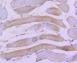 Invitrogen HSPB8 Recombinant Rabbit Monoclonal Antibody (JJ08-53) 100 &mu;L;