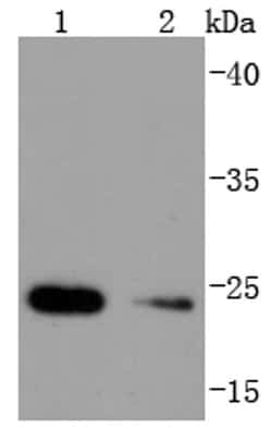 Invitrogen HSPB8 Recombinant Rabbit Monoclonal Antibody (JJ08-53) 100 &mu;L;