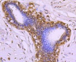 Invitrogen Cdc37 Recombinant Rabbit Monoclonal Antibody (JJ087-06) 100