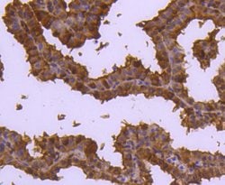 Invitrogen Cdc37 Recombinant Rabbit Monoclonal Antibody (JJ087-06) 100
