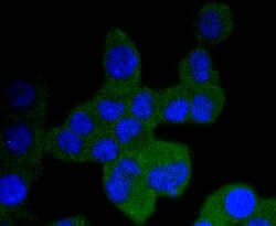 Invitrogen TrkA/TrkB/TrkC Recombinant Rabbit Monoclonal Antibody (JJ084-04)